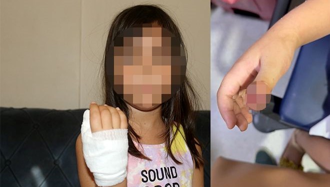 anaokulunda korkunc olay dort yasindaki cocugun parmagi koptu hJzGksqf