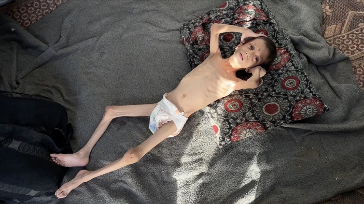 israilin kitliga surukledigi 10 yasindaki nafiz kemik yiginina donustu dNGcRes6